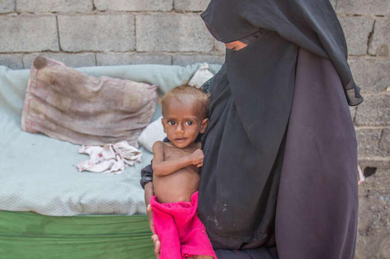 Yemenli çocuklar için ekmek yardımı çağrısı
